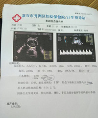 "孕28+5羊水偏少怎么办才7.7"