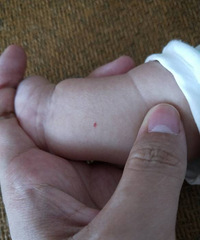 �ֱ��ϵ�С�����Ѫ�������о�����һ��