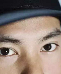 "杭州帅哥一觉醒来变“斗鸡眼”!这个坏习惯"