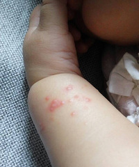 �˸��´��Ů�� ����סԺ��Ժ�󷢳�����