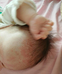 ��ͷ�������ʪ���� ����һƬ��