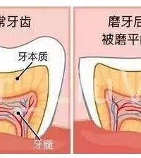 "经常用一侧牙齿吃饭的危害原来这么大..."