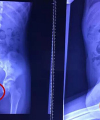 ��������8��Ů�����巴����Ѫ��ŧ����ҽԺһ��飬���趼�Ų���