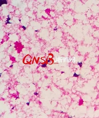 "一场突如其来的高烧后,杭州27岁孕妇产下一个死婴!这一切都是"
