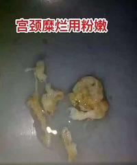 "【艾米】粉嫩私护凝胶适合什么人群?真的可以治疗宫颈糜烂吗?"