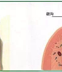 "今天,你刷牙“出血”了吗?"
