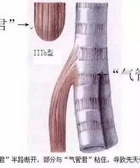 "这个宝宝怎么像螃蟹一样不停吐泡泡?医生一查竟发现..."