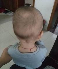 15���±���ͷ��ϡ�� ��ȱʲô΢��Ԫ����