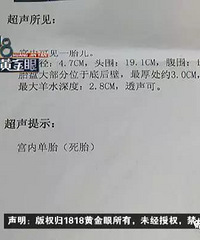 "湖州一女子在保健院做引产 父亲指责医院没做到位"