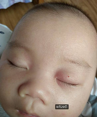 Ӥ����Ƥʪ�� ������������ ����ҩ���Ҽ���