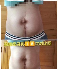 "七.服用减重药不靠谱:能让你体重下降很快"