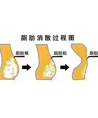 "十.由于基因差异,女性不减少脂肪摄入,光"