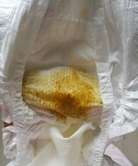 ������������к�Ѫ˿