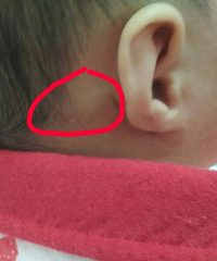 ������������һ��ָ�׸Ǵ�С��͹�� ������