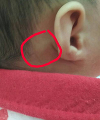 ������������һ��ָ�׸Ǵ�С��͹�� ������