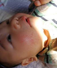 �����°�ȫ������ʪ�