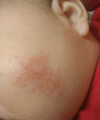 ��ĸ��ι�� ��ʪ�� ����  10�����һ�δ��