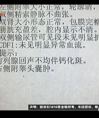 "男子在医院治疗前列腺 换家医院查又说他没问题"
