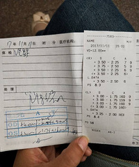 小孩远视散光