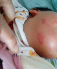 ��ҽ����ã���Ů�������ʪ��ǿ�ˮ�