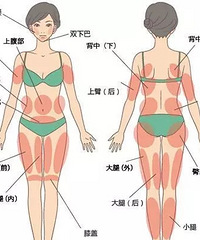 "自体脂肪丰胸适应症,丰胸不怕选择 -杭州艺星整形医院"