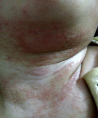 ����������ʪ�� ÿ���ˮ���̫����