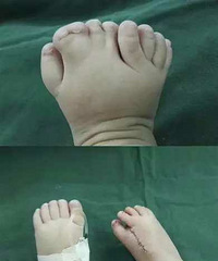 һŮӤ�ҽ���9����ֺ �����޷���ȫɸ���������