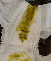 ��������������4����� ÿ��7-8�� ��㻹����Ѫ