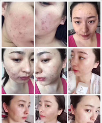 "艾璐卡有什么产品啊?听说美白祛痘效果很好?求推荐"