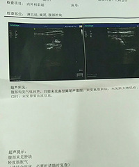 "杨医生,,6个半月宝宝,呕吐+腹泻"