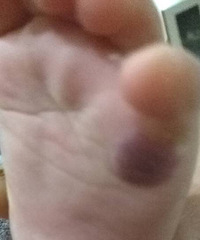 �õ��ģ�Ѫ�������ʺ�ɫ�������ɫ