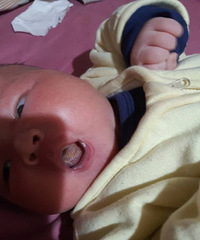 ��ѯ���� 23��Ӥ������̦