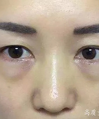 "火龙果皮不要再扔了!真没想到它居然是“眼"