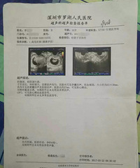 "深圳高龄产妇顺产时胎儿死亡 到底是谁拒绝"