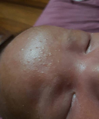 ��ѯ���� ҽ����æ������ʪ��Ǻ�����