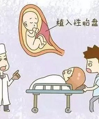 "【分娩教程】分娩全过程,准妈知悉才能让宝宝顺利出生!"