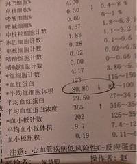 "孕检这么重要的事,婆婆为了省钱说不检查"