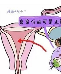 "海宁女子怀孕!受精卵却不见了...医生惊呼从医20年来没见过"