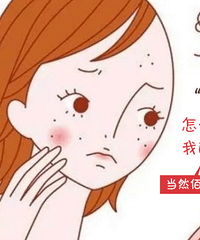 "脸上的蝴蝶斑怎样才能有效祛除?有效的祛斑方法"