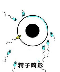 "男性精子畸形产生的原因都有哪些?"