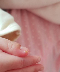 ��ҽ������æ���£�����ʲô