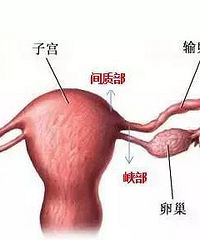 "杭州禧月阁科普|“不能生”很忧桑,可能是输卵管惹得祸"