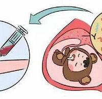 "唐筛高风险怎么办?羊水穿刺对孕妇危害大吗?"