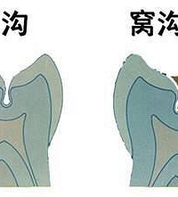 "儿童换牙期知识汇总!值得收藏起来慢慢看!"