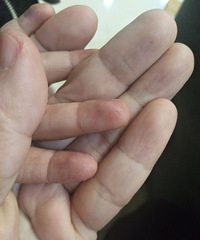 ��������Ƥ���ѿ���