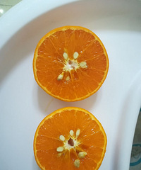 孕吐的厉害