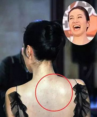"换季护肤易过敏怎么办?别慌,明星同款婚前大法来啦"
