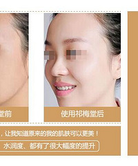 敏感肌肤怎么护理 敏感面膜护理推荐