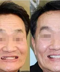 "口腔癌比宫颈癌还可怕,你却不把它当回事!"