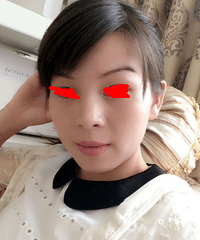 "怎么才能知道祛痘方法适合自己?分享祛痘干货"